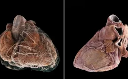 Bilim insanları, insan kalbinin iç yapısını ayrıntılı olarak gösteren, Google Earth’e benzer yeni bir teknoloji geliştirdi