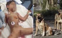Sokak köpekleri 5 yaşındaki Abbas’ı hedef aldı! Ağır yaralanan çocuk yaşam savaşı veriyor