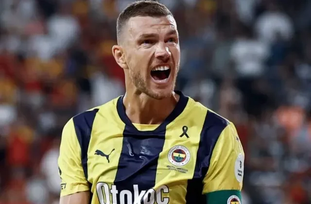 Edin Dzeko’nun elinde kırık tespit edildi