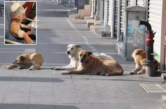 Küçük çocuk, başıboş köpeklerin saldırısında ölümden döndü