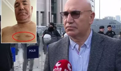 Protesto gösterisine katılan CHP’li Tanal vücudundaki yara izlerini paylaştı