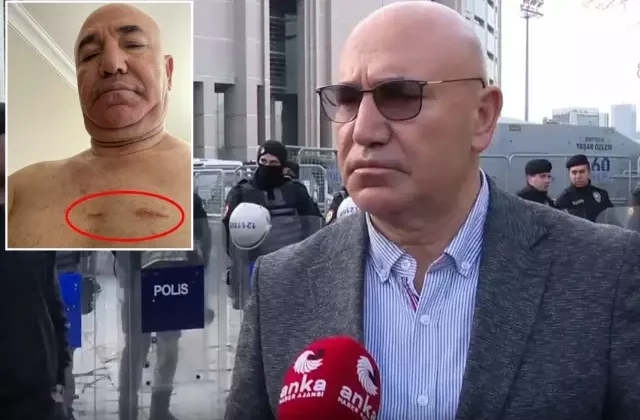 Protesto gösterisine katılan CHP’li Tanal vücudundaki yara izlerini paylaştı