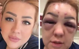 Güzelleşmek için gittiği estetik merkezinde kabusu yaşadı