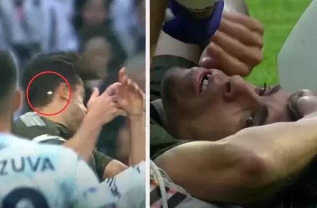 Beşiktaş’ta üst üste şanssızlıklar! 2 sakatlık, bir de dişi kırılan futbolcu
