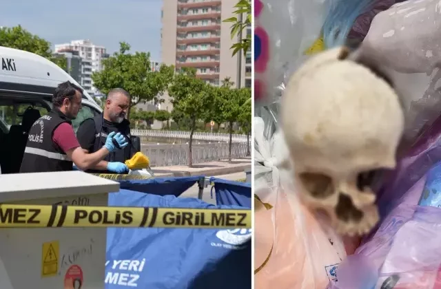 Çöpte bulunan insan kafatasını uzman doktorun eşi atmış