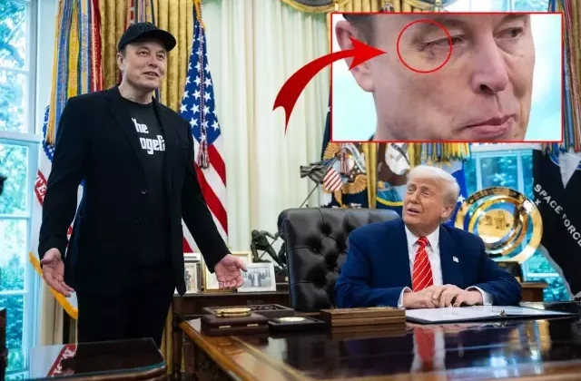 Elon Musk’ın gözüne ne oldu? Basın toplantısının önüne geçen fotoğraf