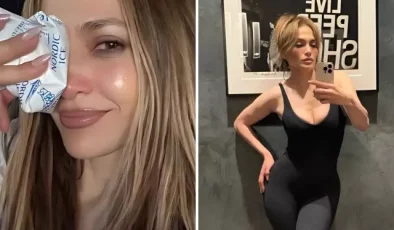 Jennifer Lopez, Amerikan Müzik Ödülleri provaları sırasında yüzünden yaralandı