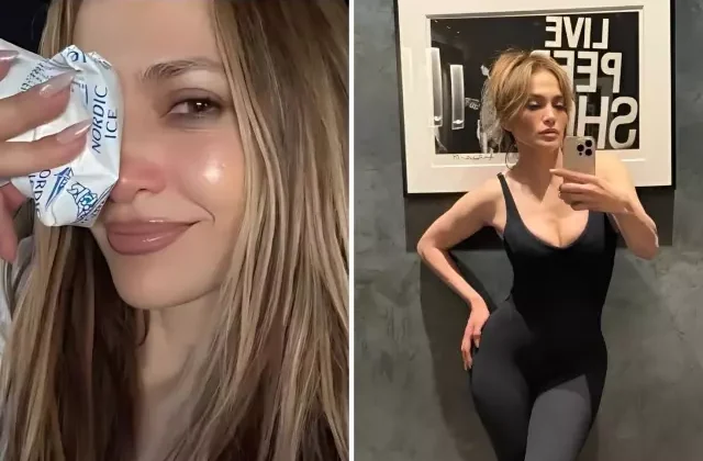 Jennifer Lopez, Amerikan Müzik Ödülleri provaları sırasında yüzünden yaralandı
