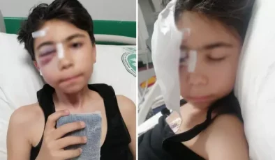 Oyun oynarken sabitlenmeyen kale direği başına düştü, çift görmeye başladı