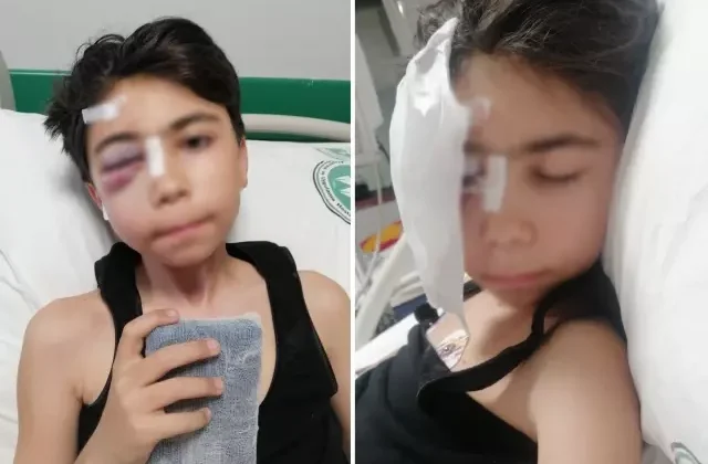 Oyun oynarken sabitlenmeyen kale direği başına düştü, çift görmeye başladı