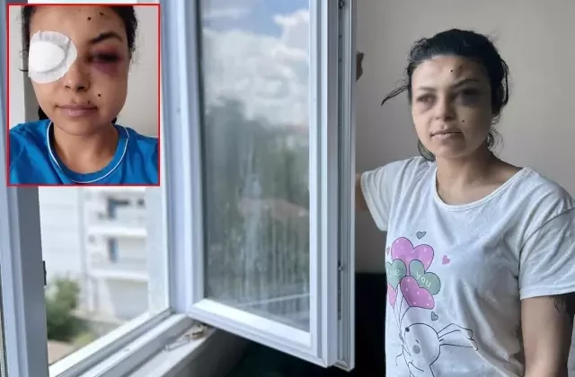Pencereden düğünü seyrederken gözünden vuruldu: Hayatım bitti