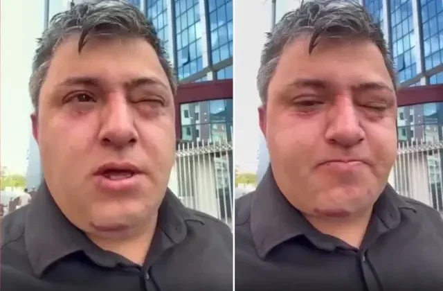 Vahim iddia: Altındağ Belediye Başkanı Tiryaki belediye işçisini darp etti