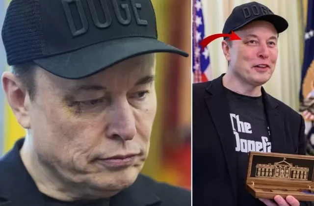 Elon Musk’ın gözündeki morlukla ilgili bomba iddia