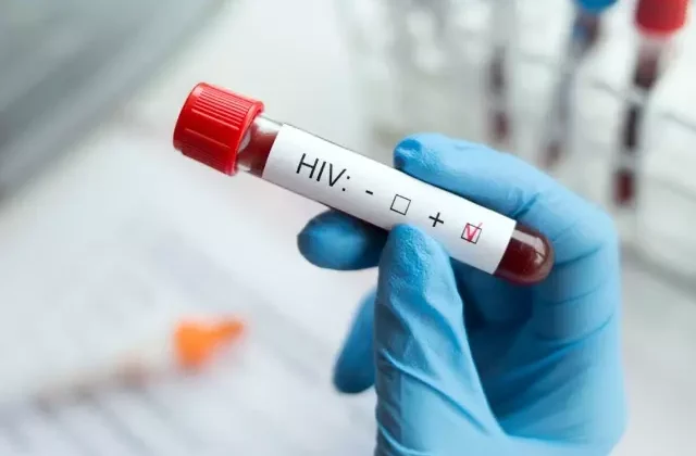 HIV tedavisinde devrim niteliğinde adım