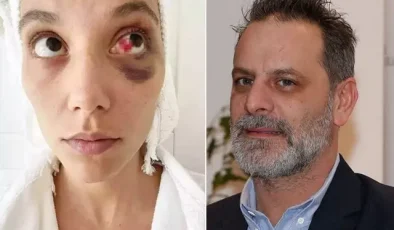 Ozan Güven’e ‘kasten yaralama’ suçundan hapis cezası