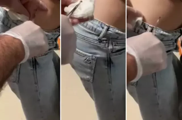 Talihsiz kadının korku dolu anları! Sivilce sandı ama gerçeği fark edince hastaneye koştu