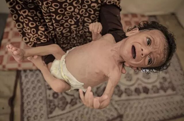 24 saatte 6 kişi daha açlıktan öldü, 7 aylık Salim bebeğin hayatı tehlike altında