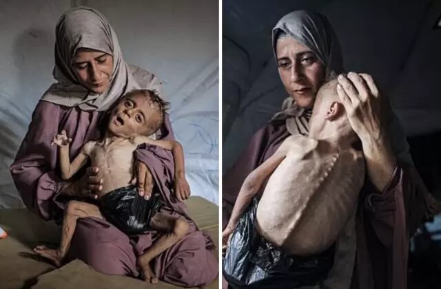 Bez yerine plastik poşet sarılmış açlıktan ölmek üzere olan çocuğun yürek burkan hikayesi
