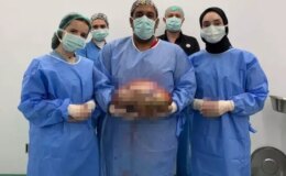 Şişlik yüzünden gitti, karnından çıkan doktorları bile şoke etti