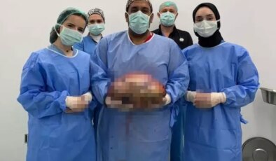 Şişlik yüzünden gitti, karnından çıkan doktorları bile şoke etti