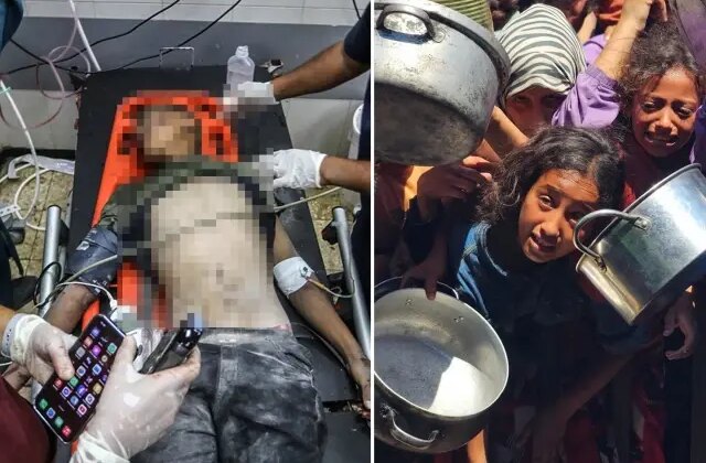 İsrail kana doymuyor! Gazze saldırılarında son 24 saatte 89 can kaybı