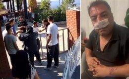 Turistlerden 4 fotoğraf için servet istediler, kavgada araya giren şoförün burnunu kırdılar