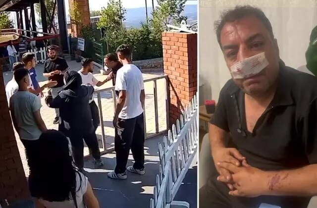 Turistlerden 4 fotoğraf için servet istediler, kavgada araya giren şoförün burnunu kırdılar