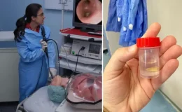 Sağ akciğeri tamamen kapandı! 5 ay önce yediği mısır tanesi az kalsın hayatından ediyordu