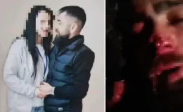 Yasak aşk dehşeti! Eski sevgilisinin ailesi işkence edip burnunu ve kulağını kopardı