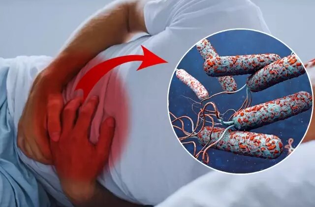 31 ülkede kolera alarmı! Ölümler her geçen saat hızla artıyor