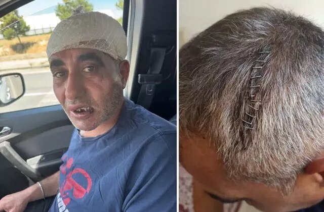 Eğlence mekanında tekme, yumruk ve sopalarla ölümüne dövüldü
