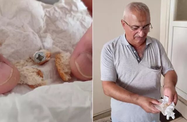 Ekmekten öyle bir şey çıktı ki! Neredeyse dişini kaybedecekti