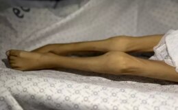 Gazze Şeridi’nde bir çocuk daha “açlıktan” öldü! 3 kiloya kadar düşmüştü