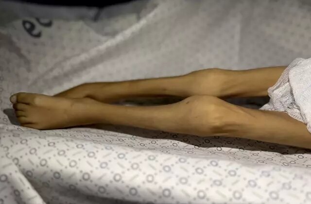 Gazze Şeridi’nde bir çocuk daha “açlıktan” öldü! 3 kiloya kadar düşmüştü