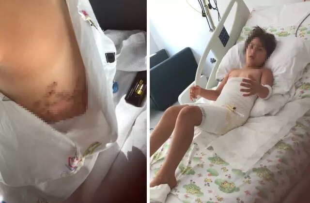 Gittikleri düğün felaketi oldu! Vücudunun yüzde 16’sı dondu