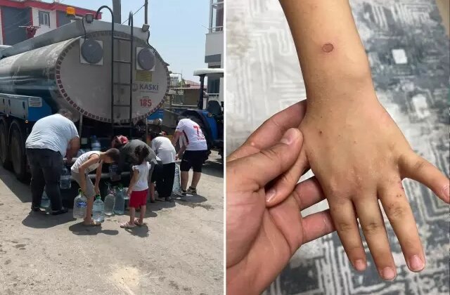 ‘Sular şehri’ Kahramanmaraş’ta 20 gündür bir damla su akmıyor, hastalıklar başladı