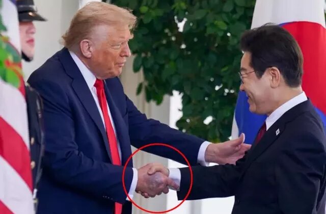 Trump’ın elindeki morluk dikkat çekti, Beyaz Saray “Sık sık el sıkışmaktan” dedi