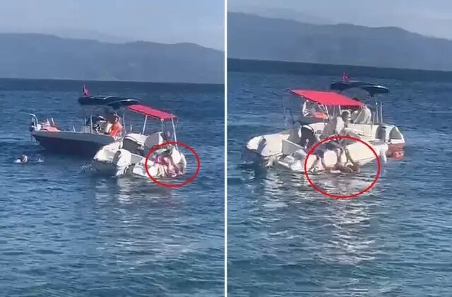 Muhtarın kullandığı sürat teknesi yaşlı kadına çarptı, kemiği kırılıp dışarı çıktı