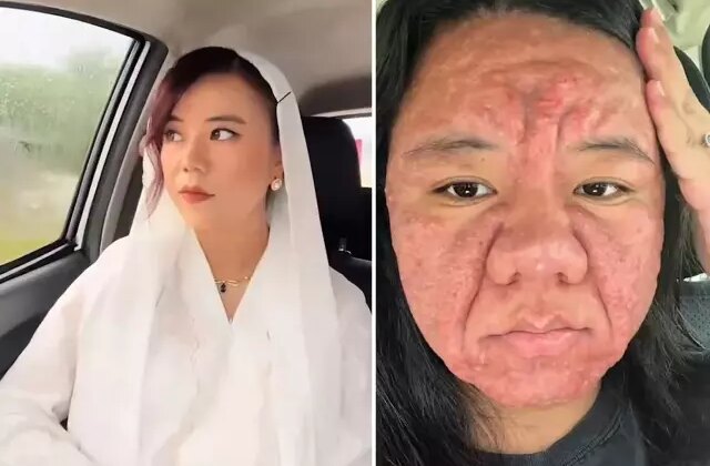 Yok böyle bir değişim: Bir anda onlarca yıl yaşlandı