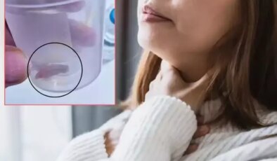 1.5 yıldır süren öksürüğünün nedeni kabak çekirdeğiymiş!