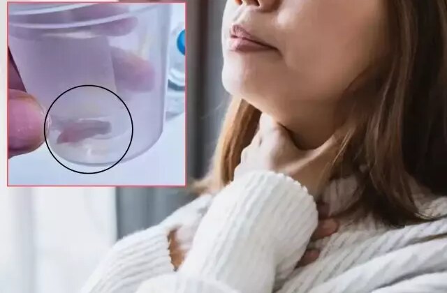 1.5 yıldır süren öksürüğünün nedeni kabak çekirdeğiymiş!