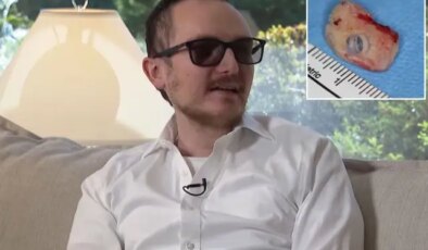 Ağzındaki diş gözüne takıldı, 20 yıl sonra körlükten kurtuldu