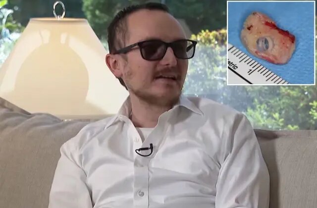 Ağzındaki diş gözüne takıldı, 20 yıl sonra körlükten kurtuldu