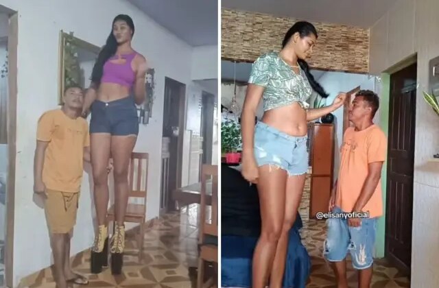 Eşiyle boy farkına meydan okudu: ‘Jigantizm’ hastalığı genç modeli mutluluğa götürdü