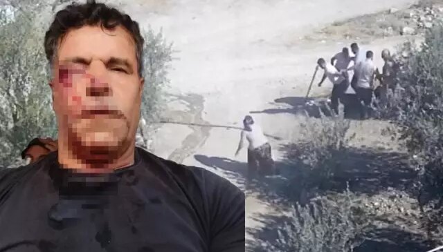 Kafasını taşla ezmek istediler, karısı düşünmeden müdahale etti