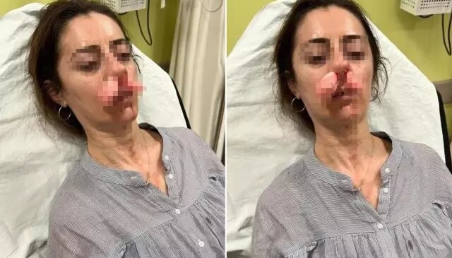 Kocasının sevgilisi zannedip öldüresiye darp etmişti! Arabanın kapısı silah sayıldı