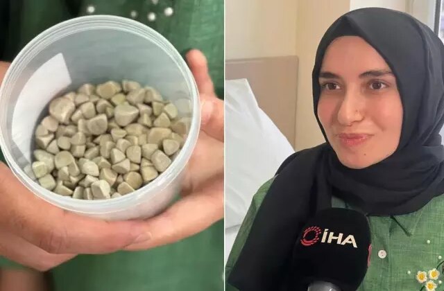 Literatüre girdi! Vücudundan 287 tane çıkarıldı, doktorlar bile şoke oldu