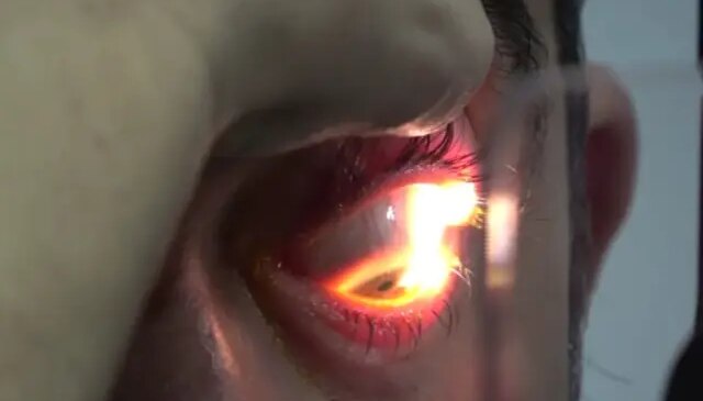 Okulda korkunç şaka! Uykuda 8 öğrencinin gözlerine yapıştırıcı sürüldü