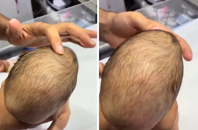 Yeni doğan bebeğin bıngıldağına basan doktorun gördüğü manzara korkunç