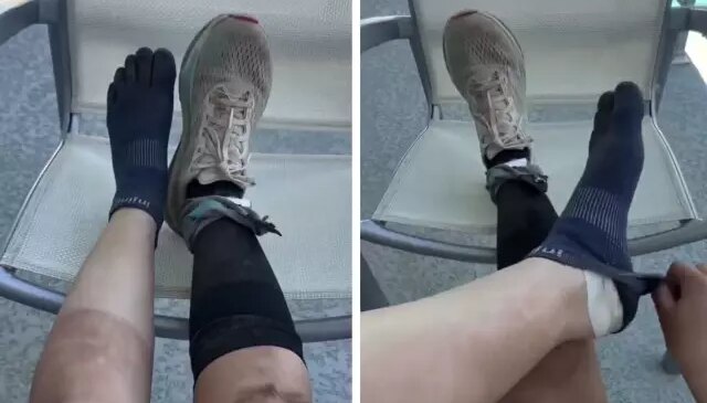 160 kilometre koşan sporcunun ayaklarının son hali inanılmaz